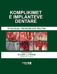 Komplikimet e Implanteve Dentare